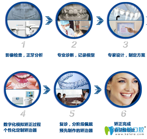 德陽新橋口腔3D數(shù)碼隱形正畸過程