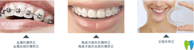 郴州植貝爾口腔三大牙齒矯正器