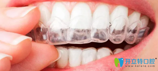 榆林長虹口腔隱形牙齒矯正器