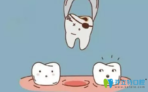 拔牙后多久可以鑲牙?聽深圳世紀(jì)河山口腔種植醫(yī)生解析