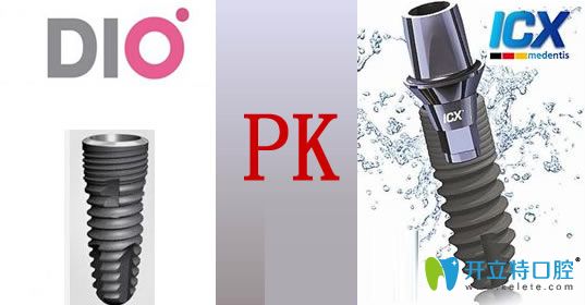 韓國dio和德國icx種植體哪個好？通過價(jià)格及優(yōu)缺點(diǎn)綜合比較