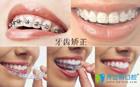 周佩佩科普：“牙齒矯正的年齡是什么時候？”