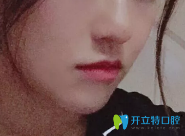 佳美口腔牙齒矯正560天照片