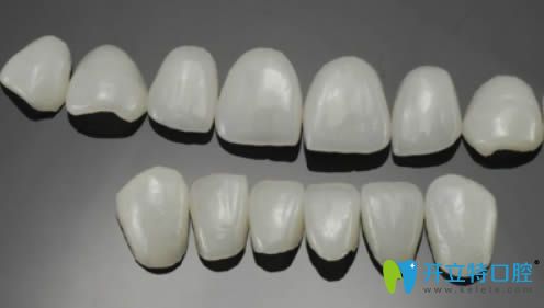 牙齒瓷貼面圖示