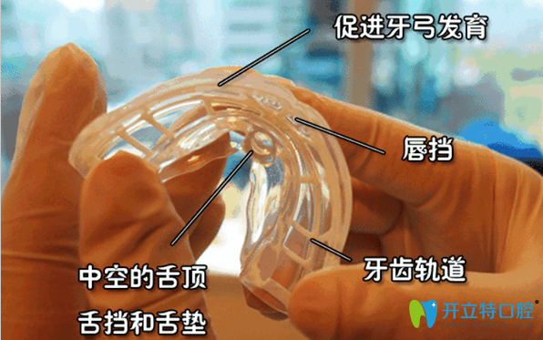 MRC肌功能矯治器的結(jié)構(gòu)和優(yōu)勢