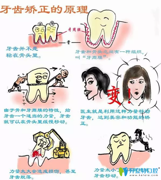 了解牙齒正畸原理后就知道正畸導(dǎo)致牙齒松是真是假