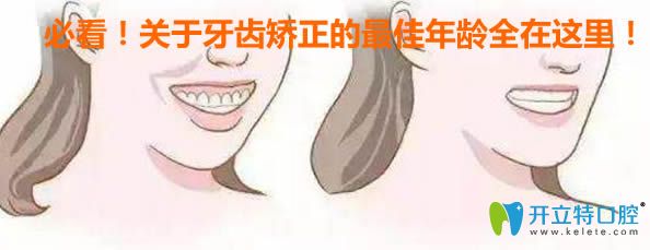 內(nèi)幕！如果錯過了牙齒矯正的較佳年齡，會讓你后悔一輩子