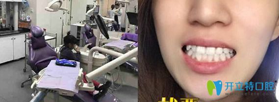 潔牙后顧客評(píng)價(jià)北京今生口腔 潔牙后顧客評(píng)價(jià)北京今生口腔