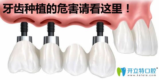 種植牙的危害有哪些？薛國初醫(yī)生來分析牙齒種植的利與弊