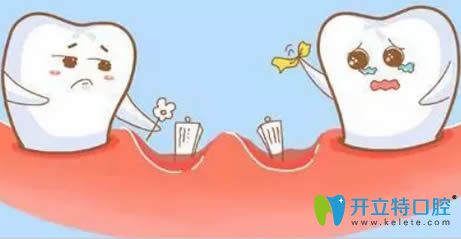牙齒缺失修復(fù)哪種方法好?來由青島天皓口腔醫(yī)生為你解答