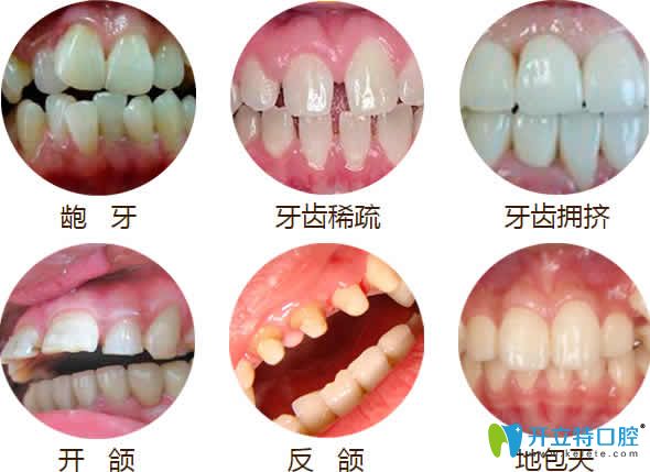 北京壹加壹口腔牙齒矯正優(yōu)勢(shì)