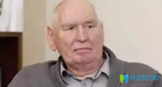 種植牙使用時(shí)間較長的42歲的瑞典人Sven Johansson