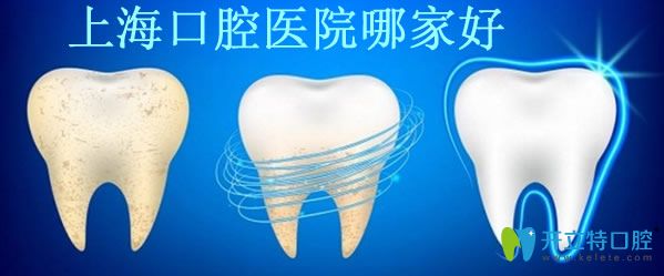 美奧口腔怎么樣 內(nèi)附牙齒矯正四大技術(shù)及收費(fèi)價(jià)格