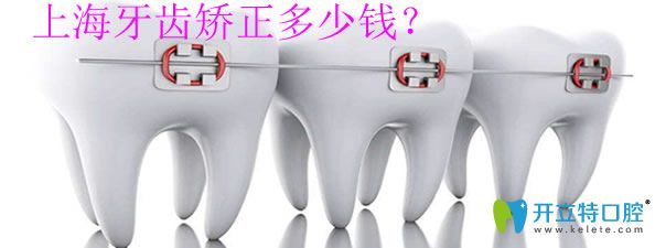 <!--<i data=20240703-sp></i>-->牙齒矯正多少錢(qián)