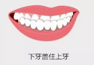 我孩子6歲牙齒是地包天 矯正價格要多少錢/年齡是幾歲