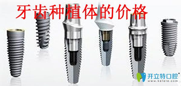 牙齒種植體的價格
