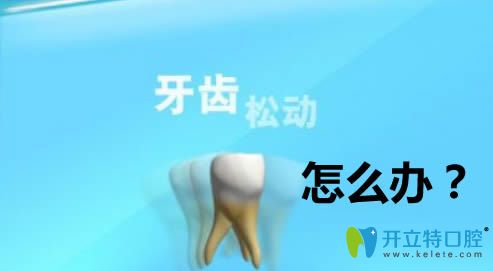 牙齒松動怎么治療？做修復(fù)的話價格大概需要多少錢？