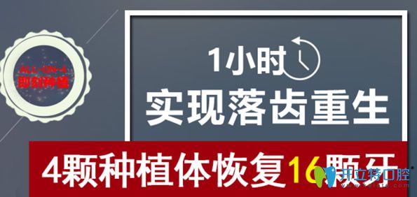 All-on-4即刻種植牙優(yōu)勢