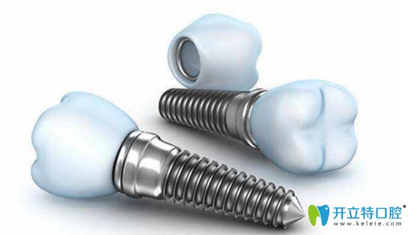 種植體品牌對種植牙價格有直接影響