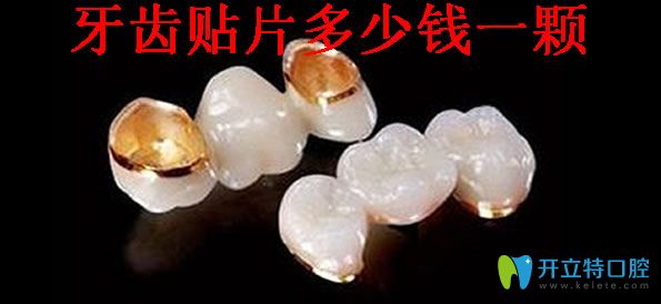 牙齒貼面多少錢一顆