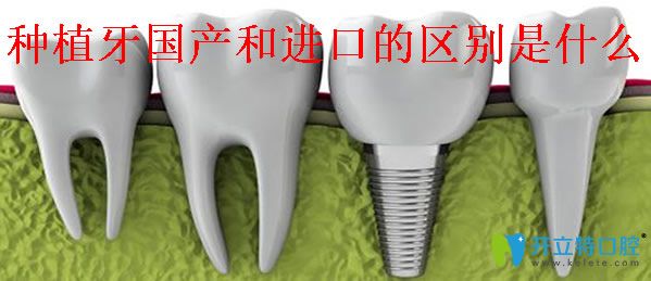 種植一顆牙價格是多少 種植牙是國產好還是進口好區(qū)別在哪