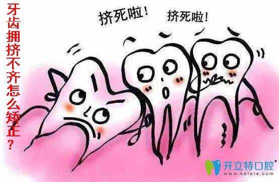 牙齒擁擠不齊怎么矯正