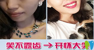 深圳麥芽口腔矯正牙齒對(duì)比圖