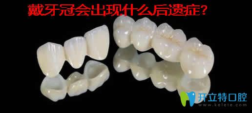 戴牙冠會出現(xiàn)什么后遺癥？介紹牙冠的種類及價格