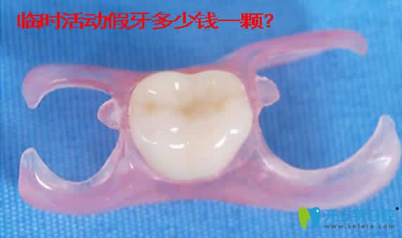 臨時活動假牙價格