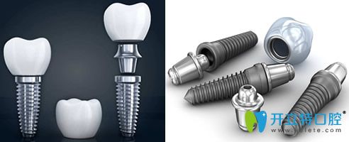 種植牙材料因素影響種植牙的價格