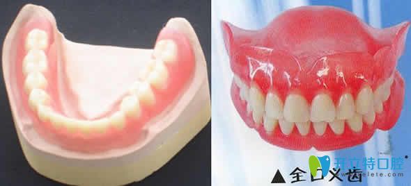 為什么很多活動(dòng)假牙會(huì)失敗 一口好的活動(dòng)假牙價(jià)格是多少錢