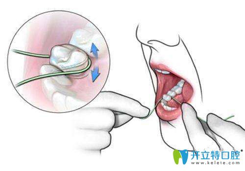 要學(xué)會(huì)使用牙線(xiàn)，保持口腔清潔