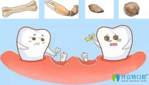 做了種植牙后能咬多硬的東西？有關(guān)種植牙的誤區(qū)看這里
