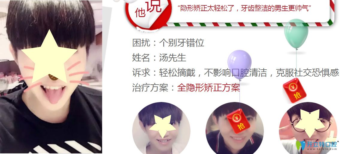 深圳格倫菲爾口腔水平怎么樣？看牙齒正畸真人案例反饋