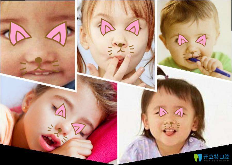 孩子有些不良的習(xí)慣可能影響牙頜的發(fā)育