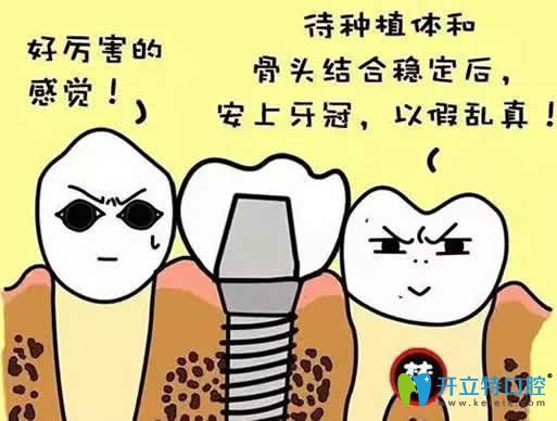 種植牙會(huì)導(dǎo)致鄰牙松動(dòng)嗎