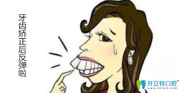 牙齒反彈必須重新整嗎