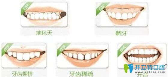 造成牙齒咬合問(wèn)題的原因