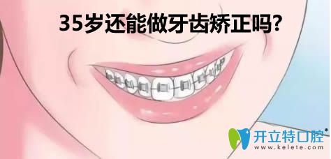 35歲還能牙齒矯正嗎?正畸醫(yī)生告訴你哪5類人不能做牙齒整形
