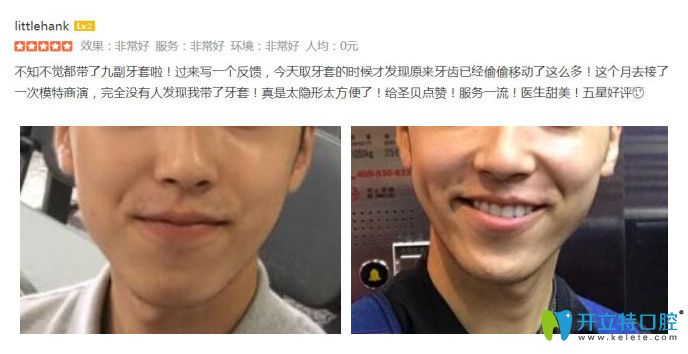 顧客在圣貝口腔做了矯正后來評(píng)價(jià)