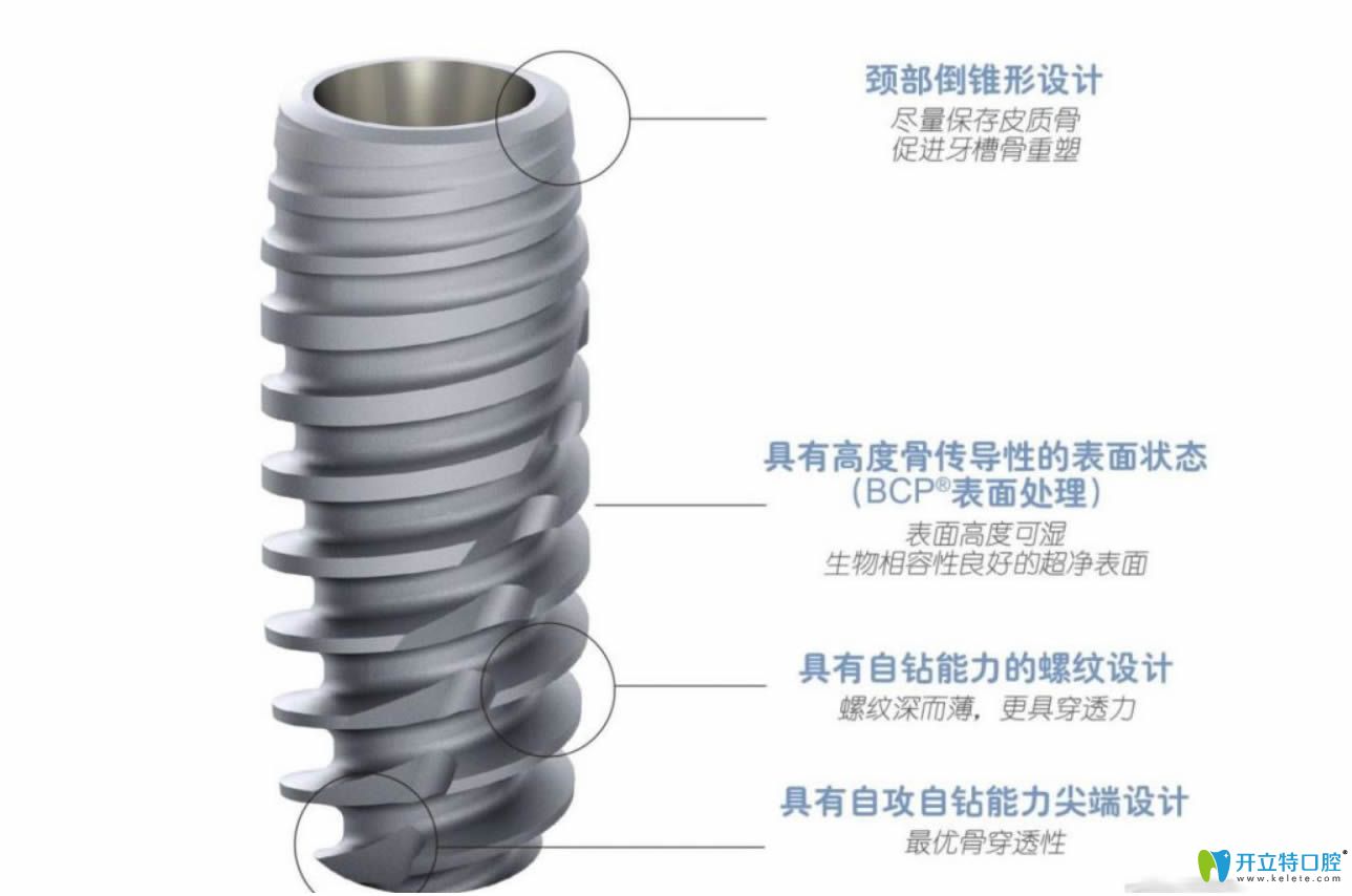 法國(guó)安卓健種植體優(yōu)勢(shì)