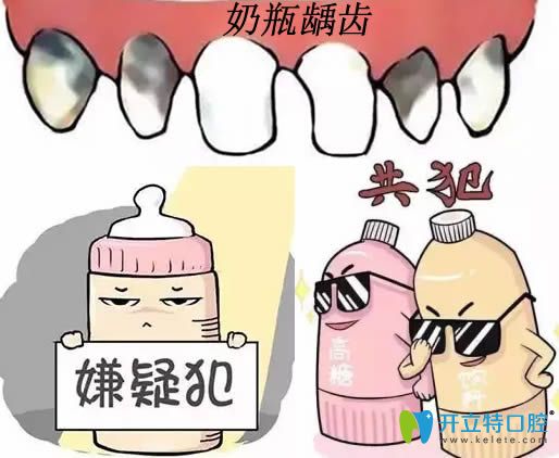 好擔(dān)心奶瓶齲會影響換牙 那寶寶奶瓶齲齒該怎么治療呢？