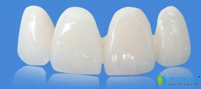 鑄瓷牙是全瓷牙嗎？鑄瓷牙和全瓷牙到底有什么區(qū)別？