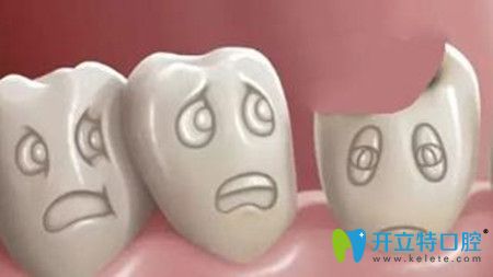 現(xiàn)在換一個牙大概要多少錢,重新做一顆牙價(jià)格在幾百或幾千