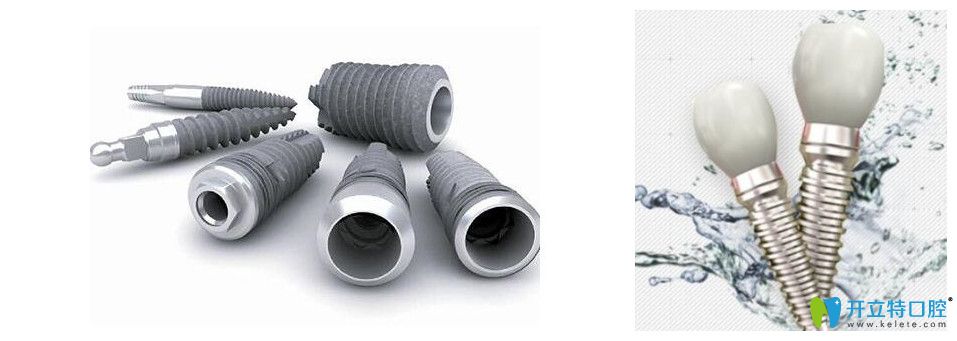 美國(guó)3i種植牙系統(tǒng)