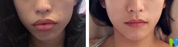 成都極光口腔怎么樣？真人案例再次證明