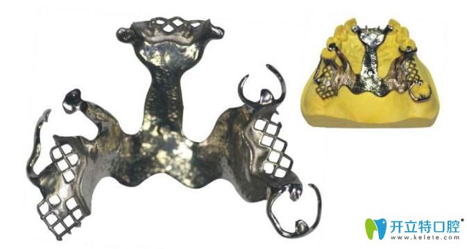 純鈦支架優(yōu)點