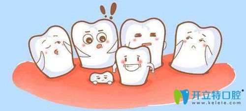 阻生牙拔不拔竟然和阻生牙的種類有關(guān)