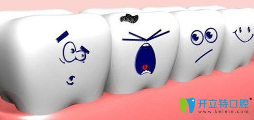 哪些阻生牙不需要拔除