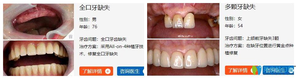 海濤口腔種植牙怎么樣？<span style=